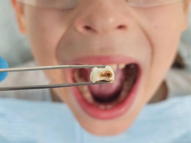 Best Pediatric Emergency Dentist in County Center, VA